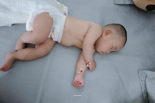 桦甸六个月宝宝眼睛散光